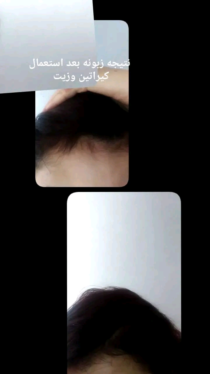 زيت الأيقونة الذهبية لشعر وكيراتين معالج أيضا